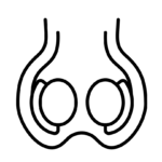 Micro TESE
