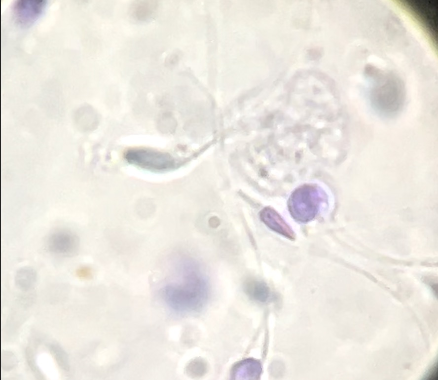 How do sperms appear under a microscope
