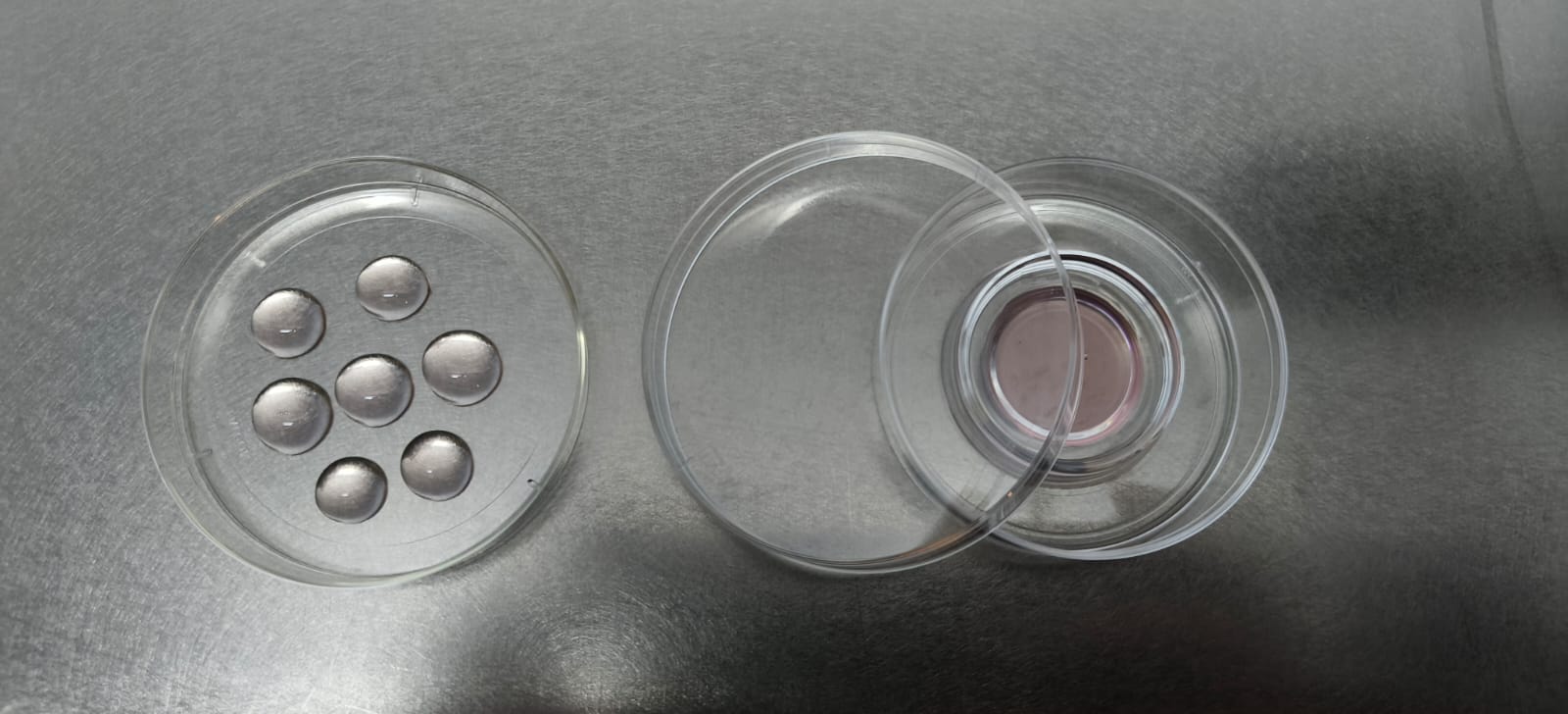 Ovum Denudation in progress at CRAAFt IVF