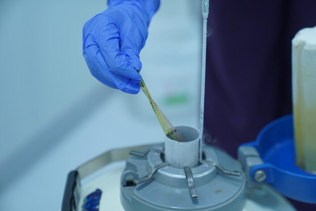 Freezing of sperms and ovum being done. 