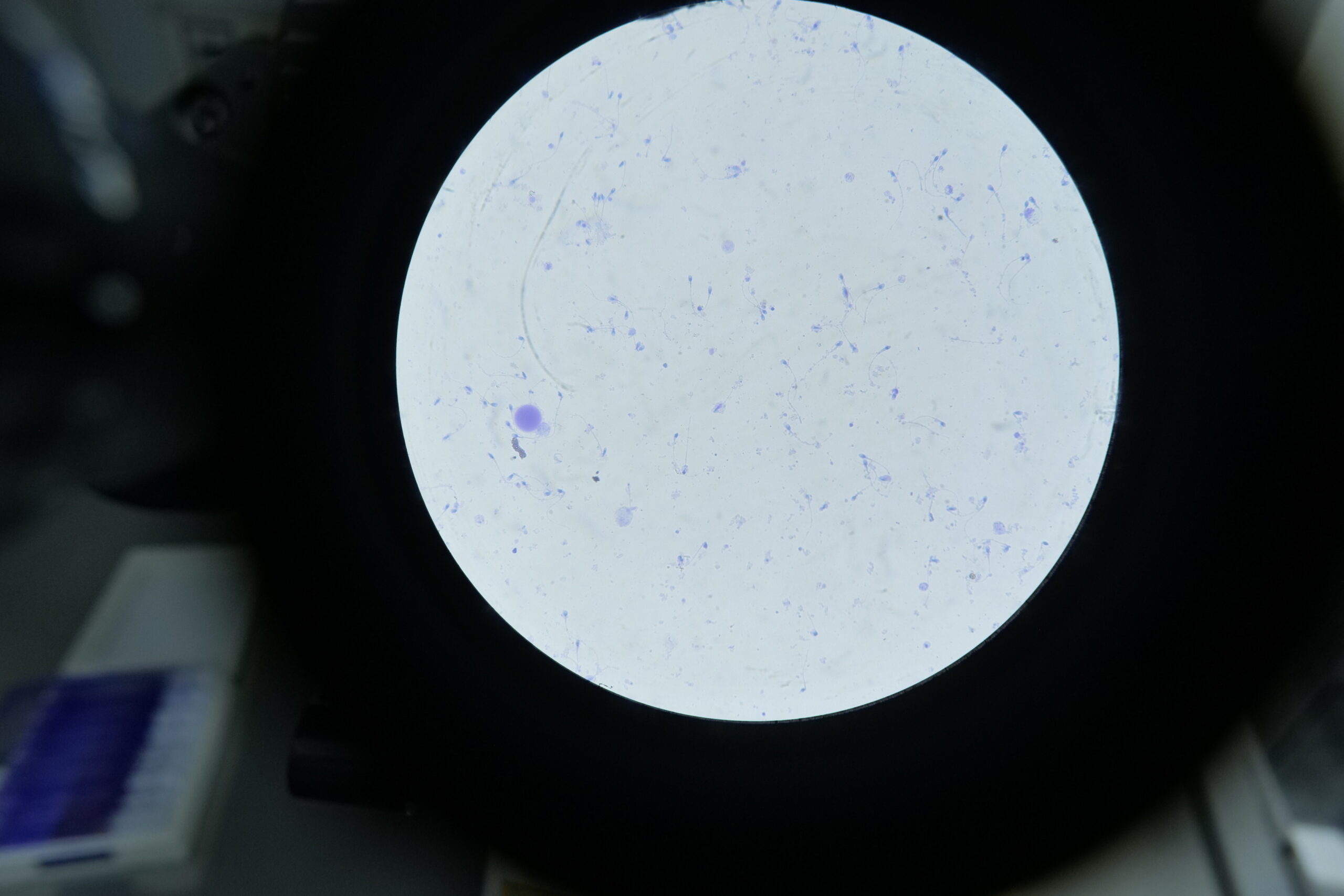 Semen Analysis: Normal Values, Results, and What They Mean for Your Fertility